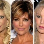 Ten Common Plastic Surgery Mistakes