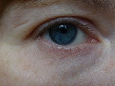 PaloviaRightEyeBefore