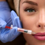 The Botox Lip Flip, Everything You Need To Know